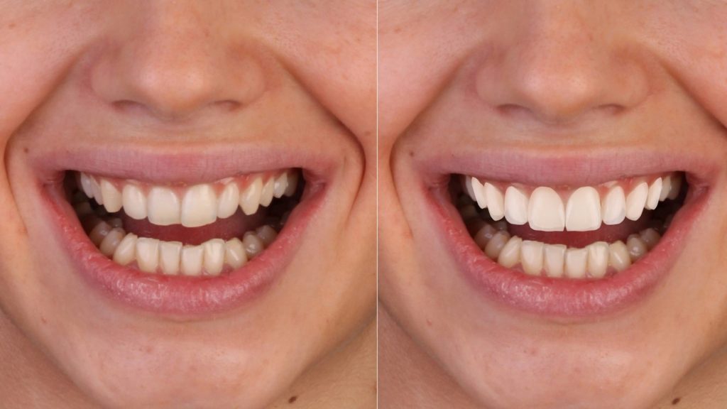 Dr Subairs Orthodontics & Dental Clinic